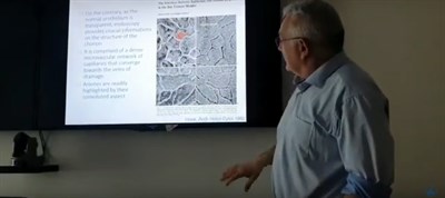 Лечение мышечно неинвазивного рака мочевого пузыря техникой биполярной En-bloc резекции